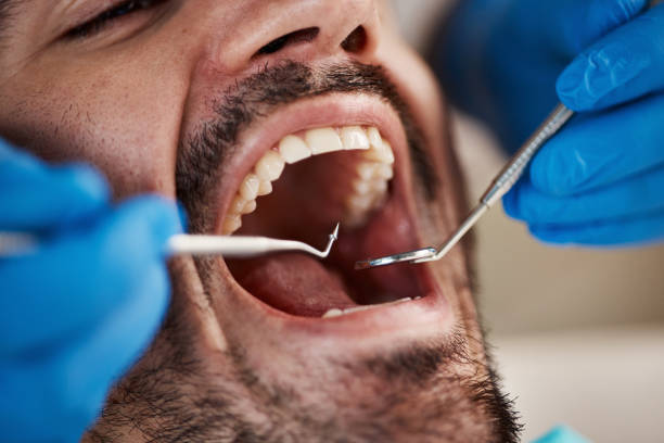 Best Emergency Dental Care for Sports Injuries in Redfield, AR