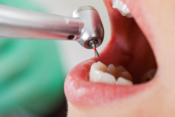 Best Emergency Treatment for Oral Infections in Redfield, AR